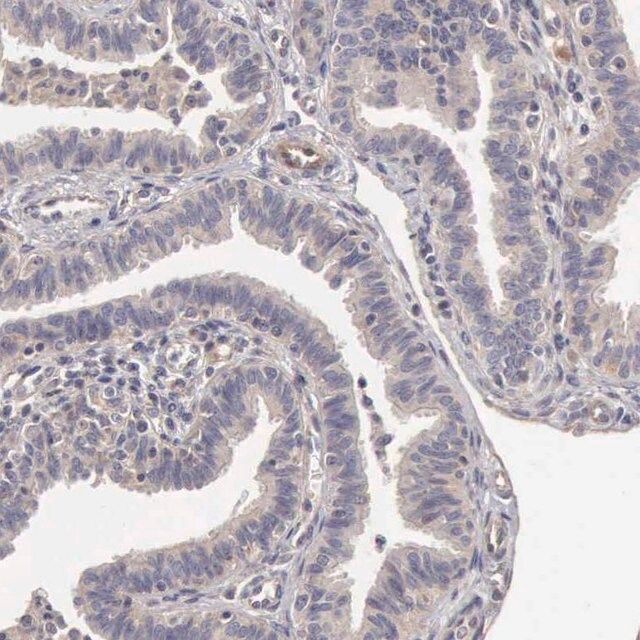 Anti BMX Antibody Produced In Rabbit