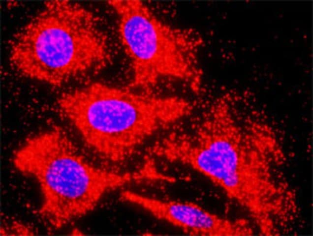 Anti-Inhbb Antibody Produced In Rabbit