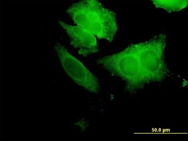 Anti-ECH1 antibody produced in mouse