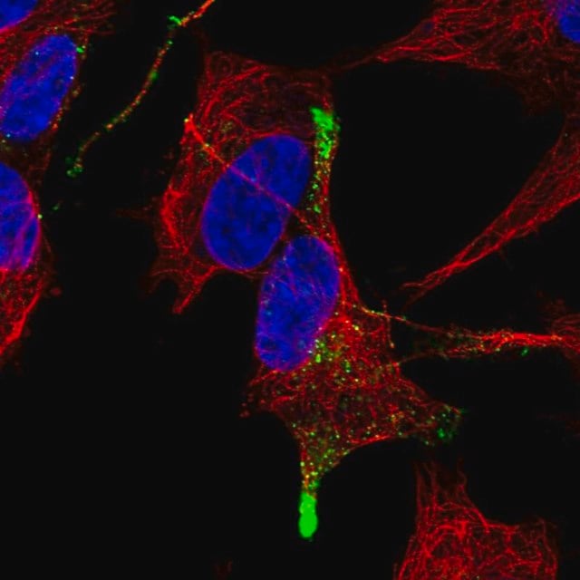 Anti TGFB3 Antibody Produced In Rabbit