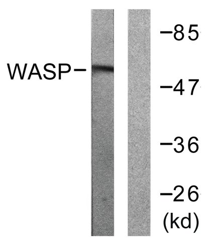 Anti WASp Antibody Produced In Rabbit